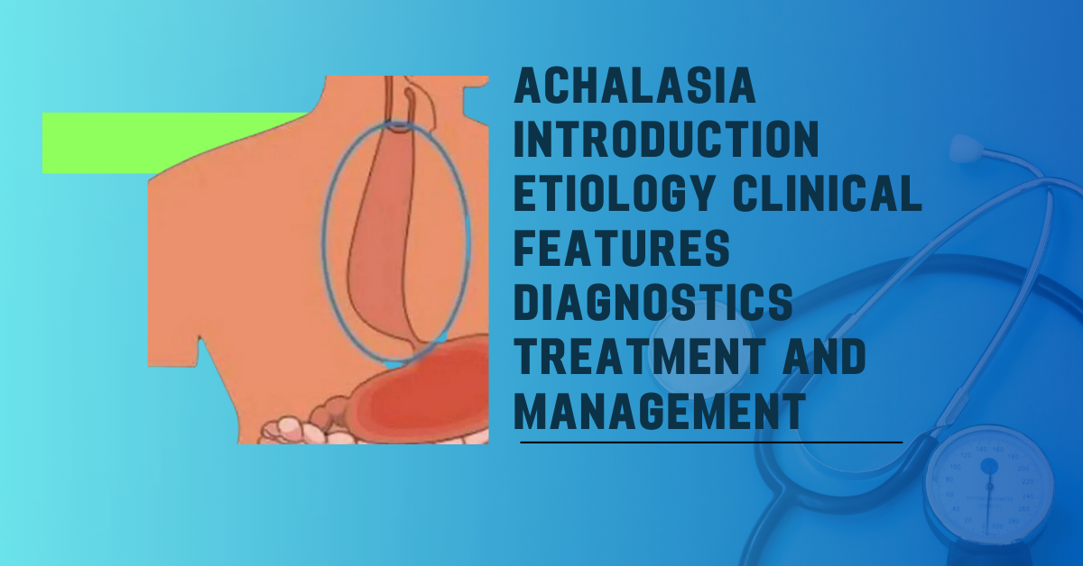 Achalasia Introduction Etiology Clinical features diagnostics Treatment and Management