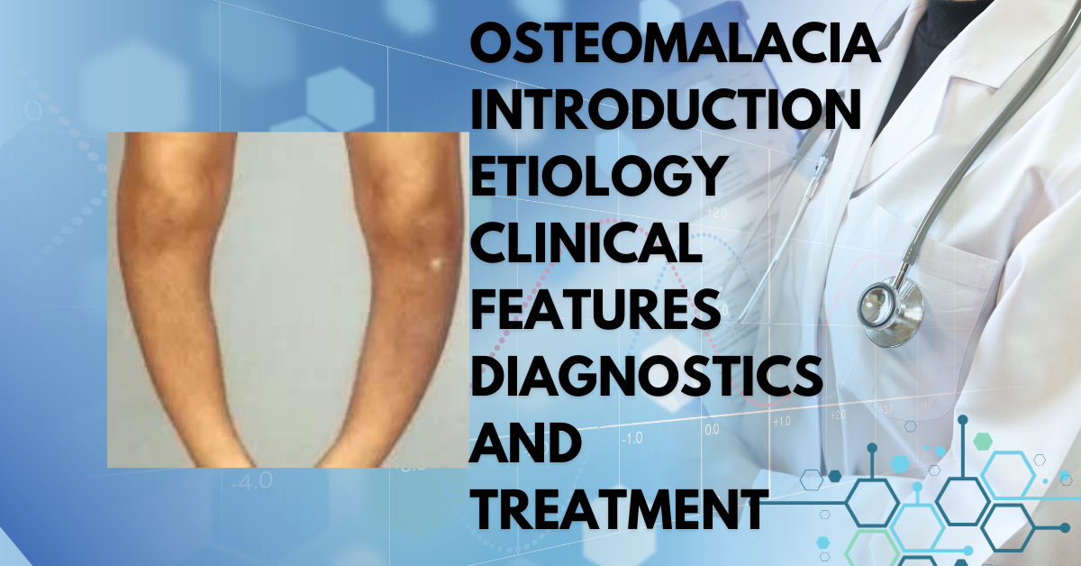 Osteomalacia Introduction Etiology Clinical features diagnostics and Treatment