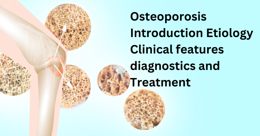 Osteoporosis Introduction Etiology Clinical features diagnostics and Treatment